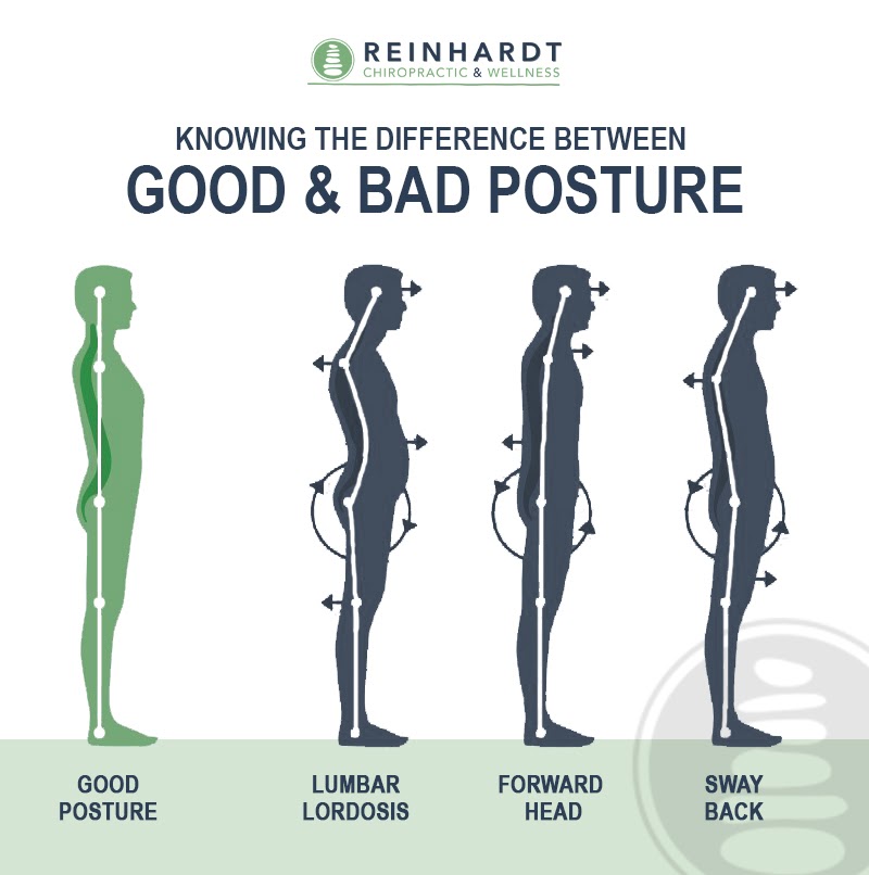 How can you improve your posture? - Chiropractor Bendigo - Chiropractic Care